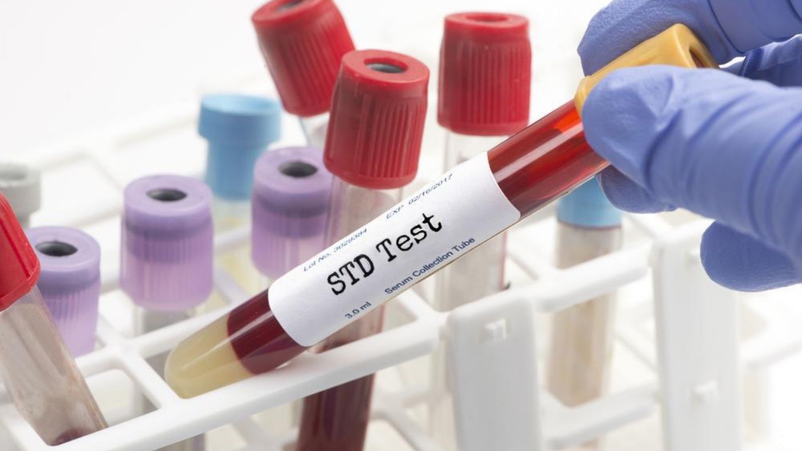 How You can Ask the Doctor for Conducting STD Tests
